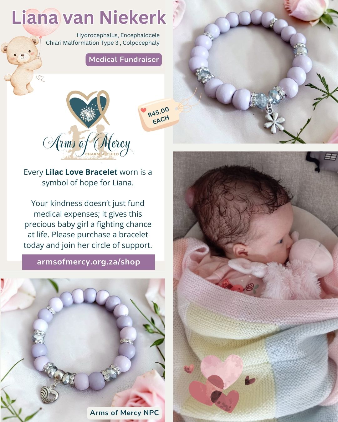 Read more about the article A Lifeline for Liana van Niekerk: A Small Warrior’s Big Journey